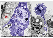 <font color="red">中山大学</font>颜光美教授团队发现杀死肝癌细胞的“烈性炸药”