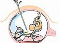 梅奥：实施新生儿医学远程医疗 降低婴儿死亡率