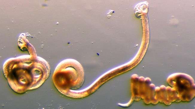 Nat Commun：科学家通过<font color="red">蠕虫</font>感染发现淋巴管生长的秘密！
