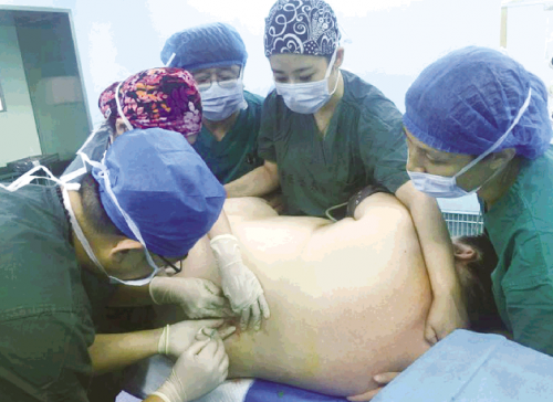 五个医生做<font color="red">麻醉</font> 东营260斤超重孕妇剖宫产子