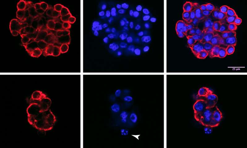 Sci Signal：研究人员发现<font color="red">小</font>分子<font color="red">核糖核酸</font>可以抑制癌细胞的生长。