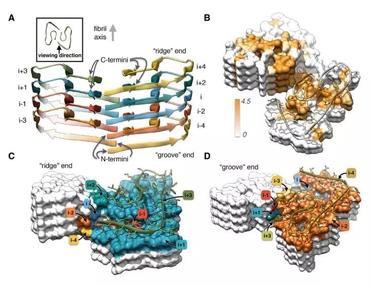 Science:阿尔茨海默病新突破：在发现β-淀粉样蛋白100多年后，科学家终于确定其高清结构！