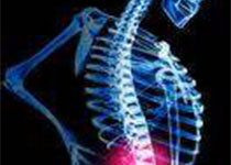 ANN RHEUM DIS：强直性脊柱炎中TNF阻滞剂通过减少疾病活动抑制脊柱影像学进展
