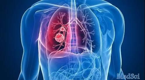 振奋人心！深圳团队利用ctDNA检测肺癌，总检出率达91%，癌症变为不死慢性病终将实现！