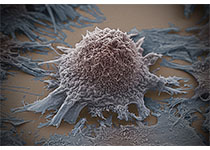 Cell：发现非小细胞肺癌治疗新方法