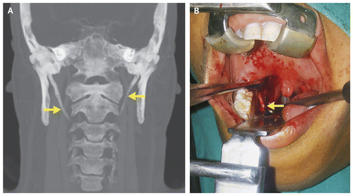 盘点9月nejm精彩病例汇总