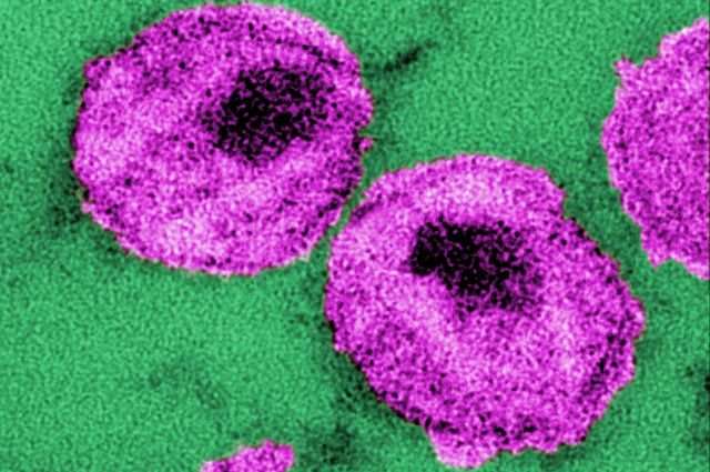 PLoS Pathog：这种新型分子或是HIV患者真正存活的希望！