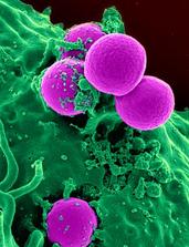 Sci Rep：Ag-CFx可抑制细菌生物膜的形成，有效对抗感染