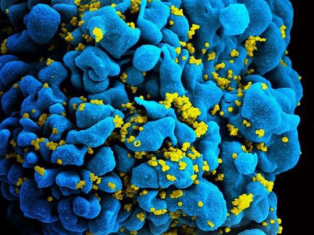 PLoS Pathog：科学家通过重建免疫系统有望将HIV彻底击败！