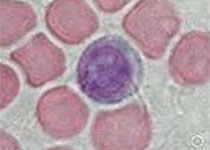 Nat Commun：这种胆固醇<font color="red">代谢</font><font color="red">产物</font>“劫持”免疫细胞，让癌症扩散