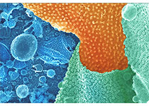 Mol Cell：从主要癌症基因中找到突破口