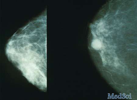 GENETICS in MEDICINE ：研究人员查明了乳腺癌基因检测激增的原因