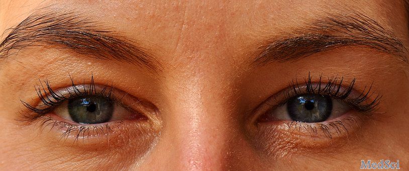 Sci Rep：由钝性眼创伤引起的视网膜色素上皮细胞后遗症：发病、视觉效果及相关因素！