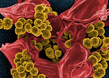 Cell Mol Life <font color="red">Sci</font>：蛋白激酶<font color="red">D</font>抑制剂CRT0066101通过在G2 / M阻断细胞周期抑制膀胱癌细胞体外和异种移植物的生长。