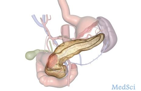 Gastroenterology： 无酒精下行胰腺囊肿消融是可行的