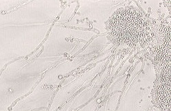 Sci Immunol：机体抵抗口腔疾病的机制