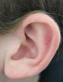 Stem Cell Reports：科学家成功将内耳干细胞转化成听觉神经元治疗听力丧失！