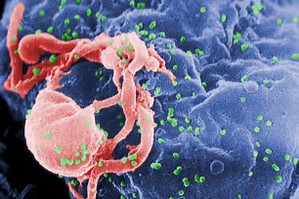 PNAS：艾滋病病毒隐身传播全新细节曝光
