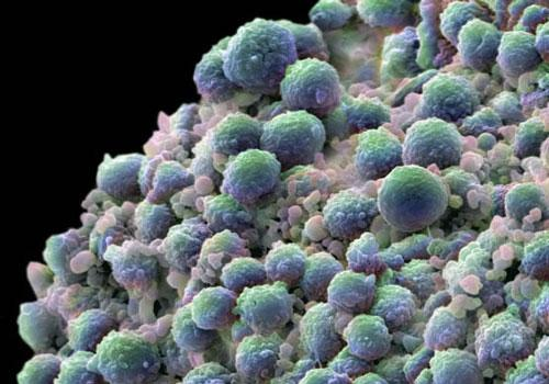 Hum Mol Genet：大肠癌组织缺氧区可改变miRNAs的表达