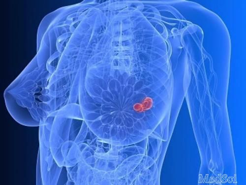 JCO：度洛西汀治疗早期乳腺癌患者芳香化酶抑制剂治疗所致的关节痛效果如何？