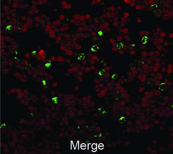 Sci Trans Med：科学家给小鼠注射产生PD-L1<font color="red">的</font>干细胞已成功逆转糖尿病！
