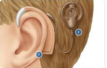 FDA批准远程医疗方案对植入人工耳蜗进行编程