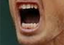 Int J Oral Max Surg： 成年人群第三<font color="red">磨牙</font>的症状