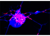 Cancer Res：<font color="red">Cic</font>突变通过神经干细胞异常增殖和分化促进神经胶质瘤发生