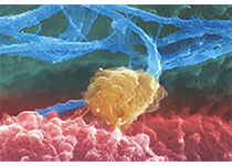 Cell host Microbe：新发现幽门螺杆菌引起胃癌的两种机制