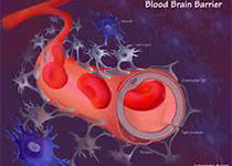 Diabetic Med：在黑人<font color="red">妇女</font><font color="red">健康</font>研究中种族主义感知和糖尿病事件