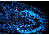 Biomed Res Int：rhBMP-2<font color="red">膜</font>是否可增强<font color="red">成</font><font color="red">骨</font>？