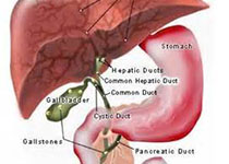 临床肝胆病杂志：原发性胆汁性<font color="red">胆管炎</font>的临床特征与治疗分层管理