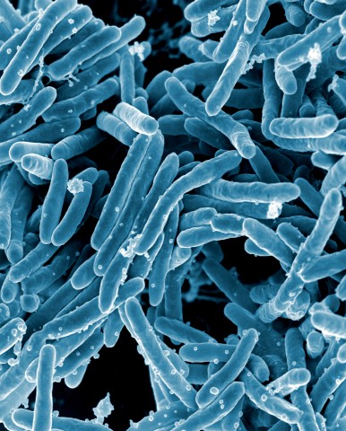 Cellul Microbio：结核分枝<font color="red">杆菌</font>入侵机制研究取得进展