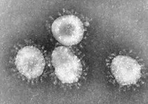 PLoS Pathog：武汉病毒所在SARS冠状病毒起源与进化研究中取得新进展