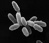 Gut Microbes：运动多的小鼠肠道<font color="red">菌</font>群更健康