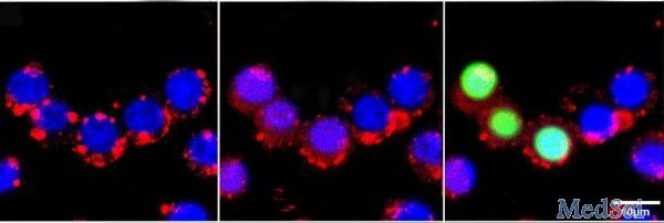 Cell Physiol Biochem：通过靶向CCNG2，外泌体miR-1246可促进乳<font color="red">腺癌</font>的进展