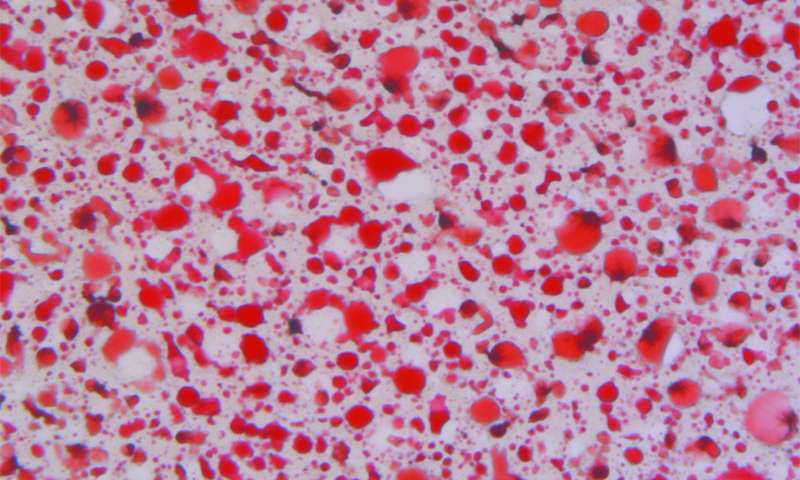 Cancer Cell：研究发现引发肝癌<font color="red">形成</font>的罪魁祸首！