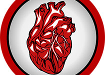 Heart：主动脉根部解剖变异可影响TAVR结局