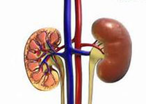 Kidney int：IL-36R在肾脏缺血再灌注损伤的重要作用！