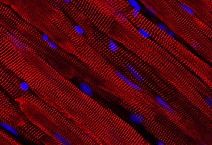 Biomaterials：新型多功能复合纳米材料可用于<font color="red">骨骼肌</font>的再生