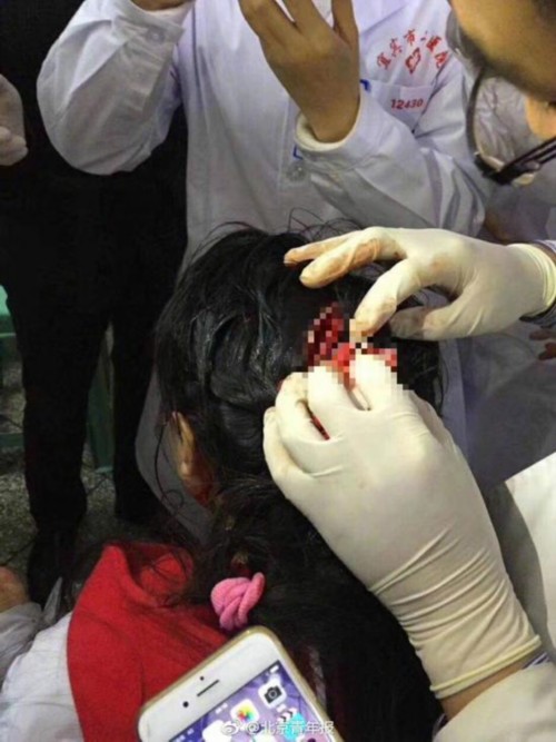 女医生被患者砍伤后脑 医院:受伤者并非其<font color="red">主治</font>医生