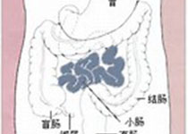 Am J Gastroenterol：克罗恩小肠磁共振、内镜愈合与预后