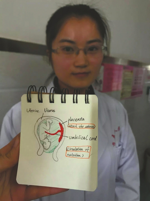 <font color="red">成都</font>医生手绘英文插图 助外籍孕妇顺利生产