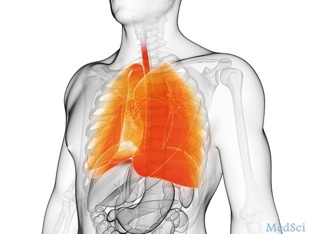 AZ和ICL合作研究呼吸道疾病