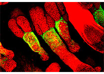 Cell Res：徐彦辉组解析人源ATR-ATRIP结构揭示DNA损伤应答机制