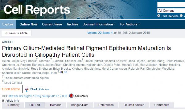 Cell Rep：美研究有望改进老年黄斑变性<font color="red">干细胞</font>疗法