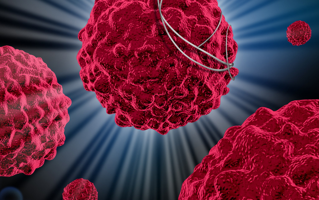新免疫疗法可治疗多种癌症，临床试验初步<font color="red">成功</font>