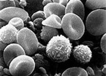 Blood：微环境诱导的<font color="red">CD</font><font color="red">44</font>v6突变可促进慢性淋巴细胞白血病的早期进展。