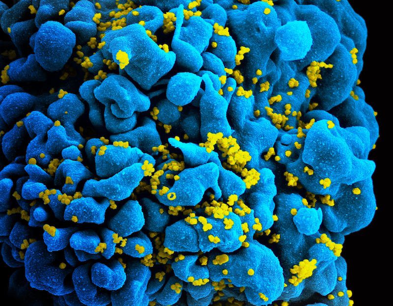 Sci <font color="red">Immun</font>：新发现为改进HIV和丙肝疫苗提供新思路