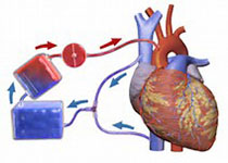 Hypertension：心血管疾病在原发性醛固酮患者中的患病率，及其影响因素。